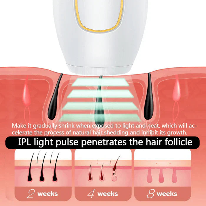 NoHair IPL Epilator™