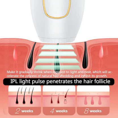 NoHair IPL Epilator™